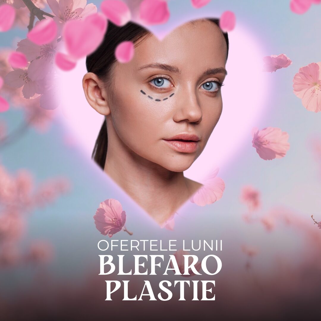 Blefaroplastie rezultat 2