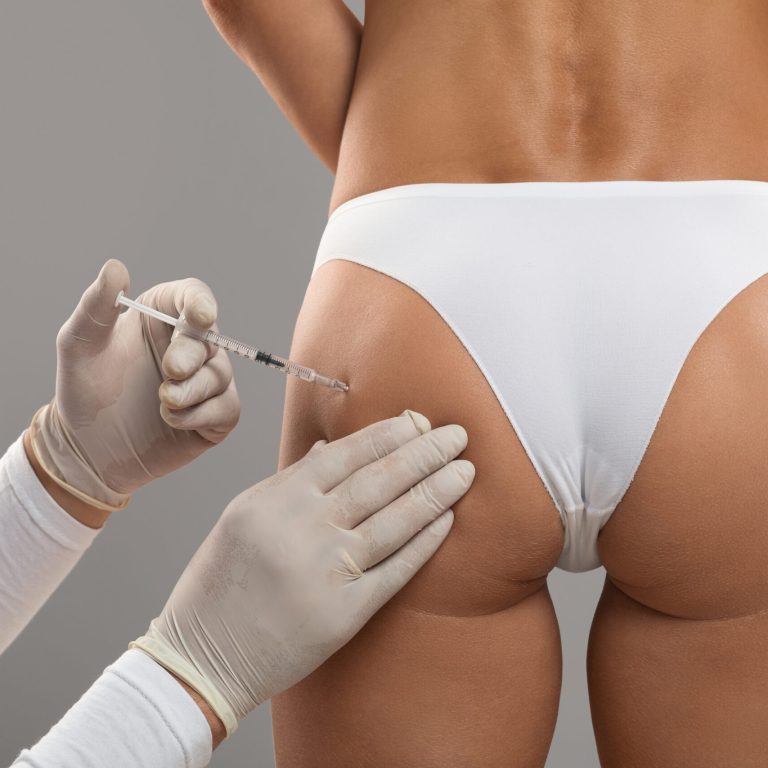 Anti-Cellulite Care. Young Woman In Underwear Having Lipolysis Treatment At Beauty Salon, Unrecognizable Beautician In Gloves Making Injection Shot To Female Buttocks With Smooth Skin, Closeup